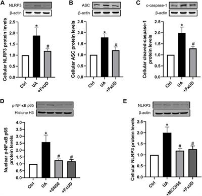 Pharmacological Basis for Use of a Novel Compound in Hyperuricemia: Anti-Hyperuricemic and Anti-Inflammatory Effects